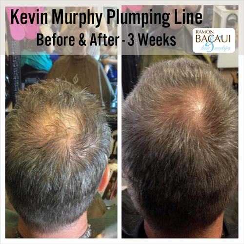 Kevin Murphy Plumping Line Before and After